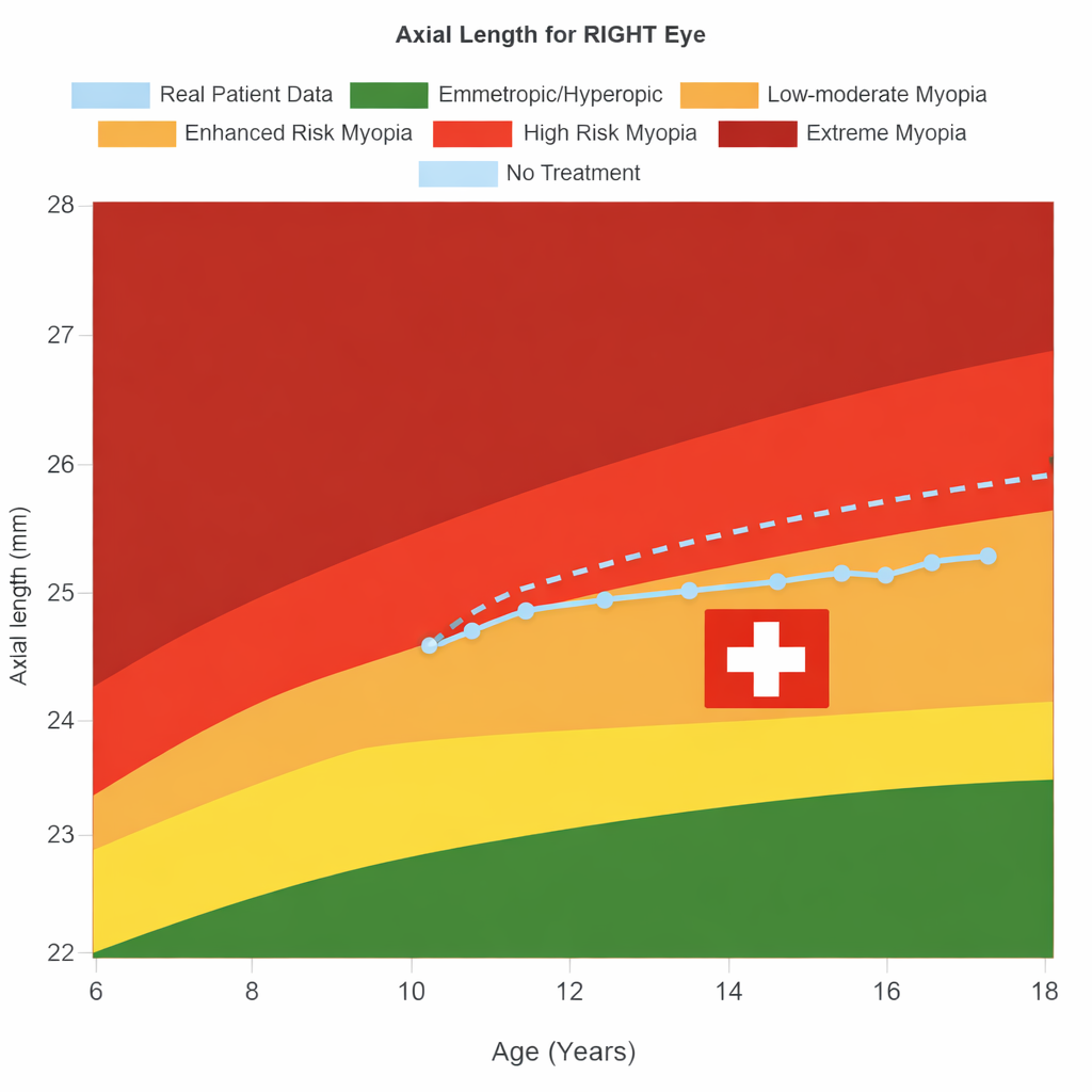 MiGeL curve for assessing high myopia and checking MiGeL reimbursement eligibility